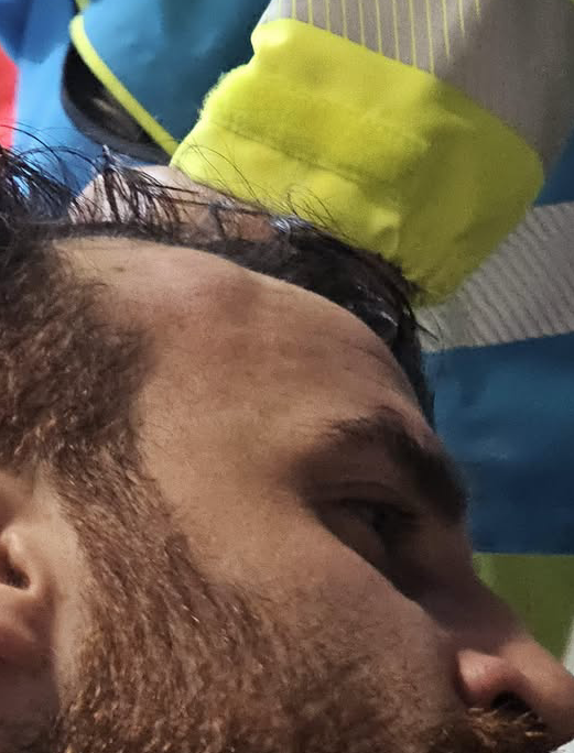 renga aggredito benevento 5B