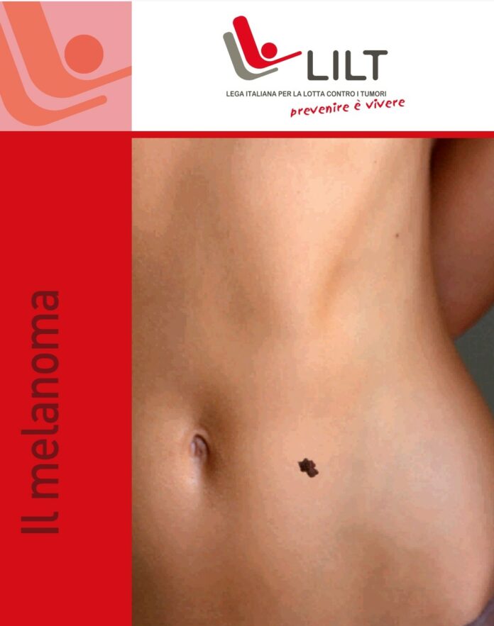Locandina melanoma